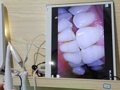 dental oral camera testing