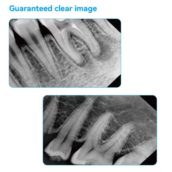 dental-rvg-x-ray